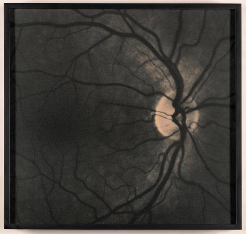 Retinas, from Genetic Self-Portraits