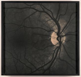 Retinas, from Genetic Self-Portraits